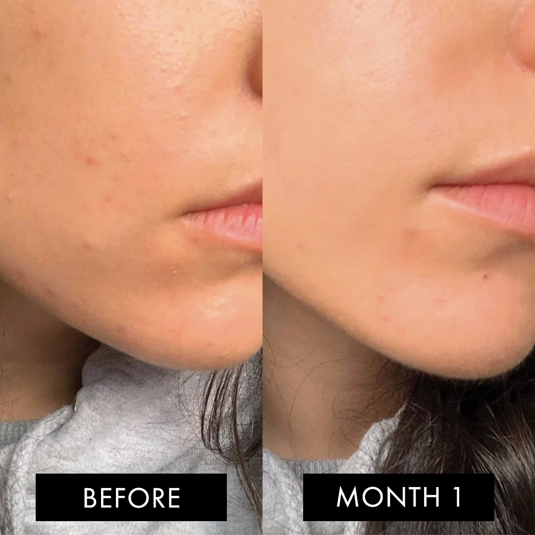 The Skin Elixir Three Month Pack - Image 10