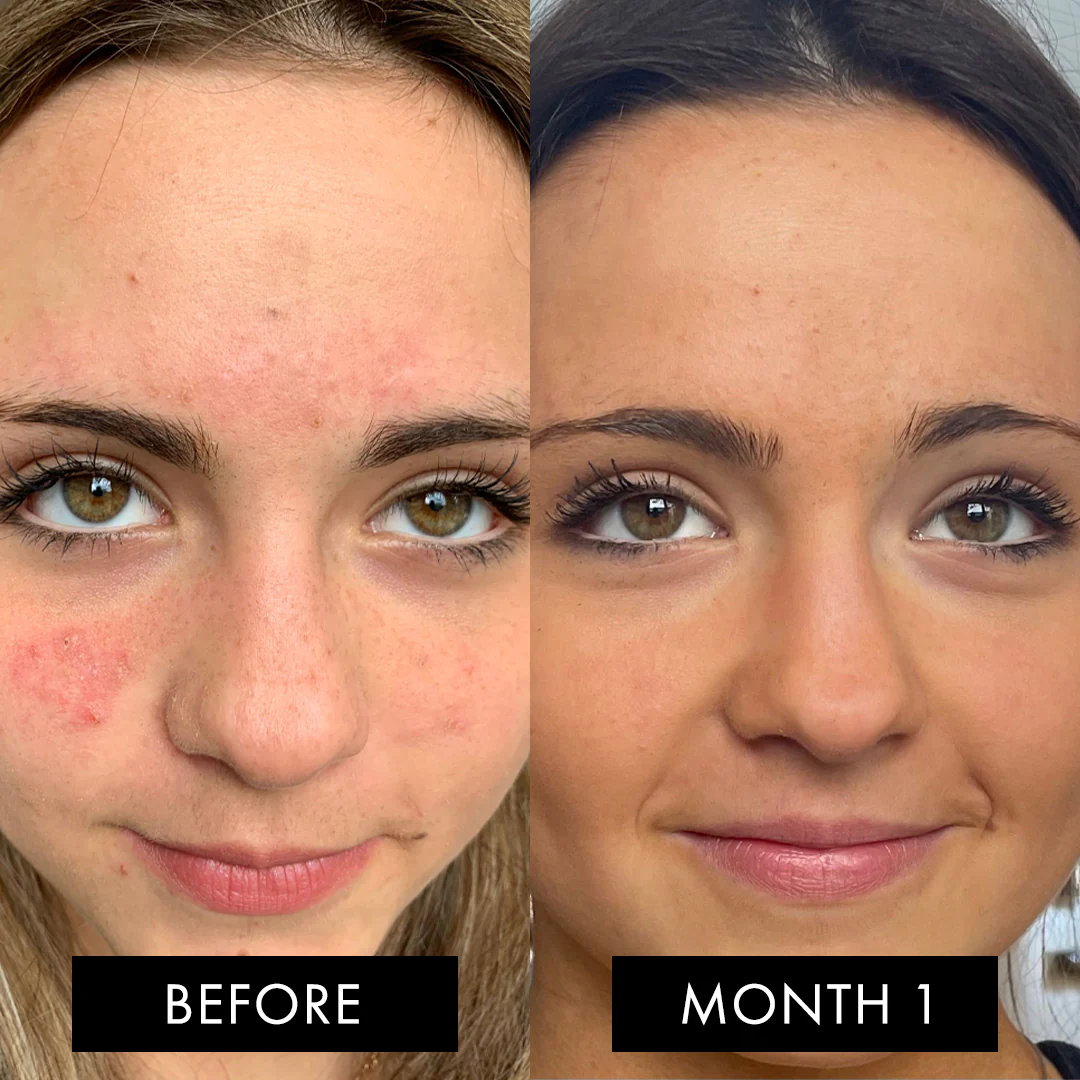 The Skin Elixir Three Month Pack - Image 8